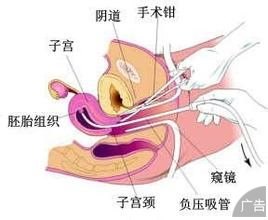 做人流手术哪个医院好