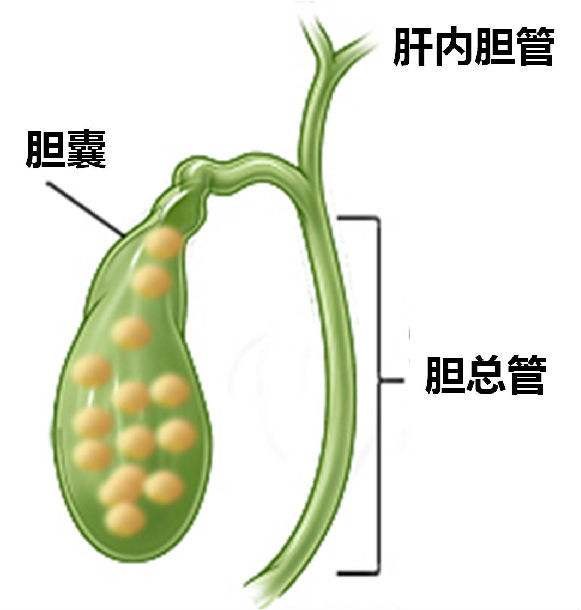 胆囊结石的检查项目有哪些