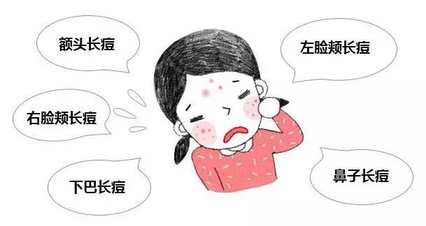 痤疮的治疗方法有哪些