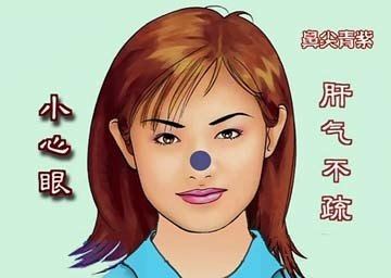 女性脸色暗黄是怎么回事